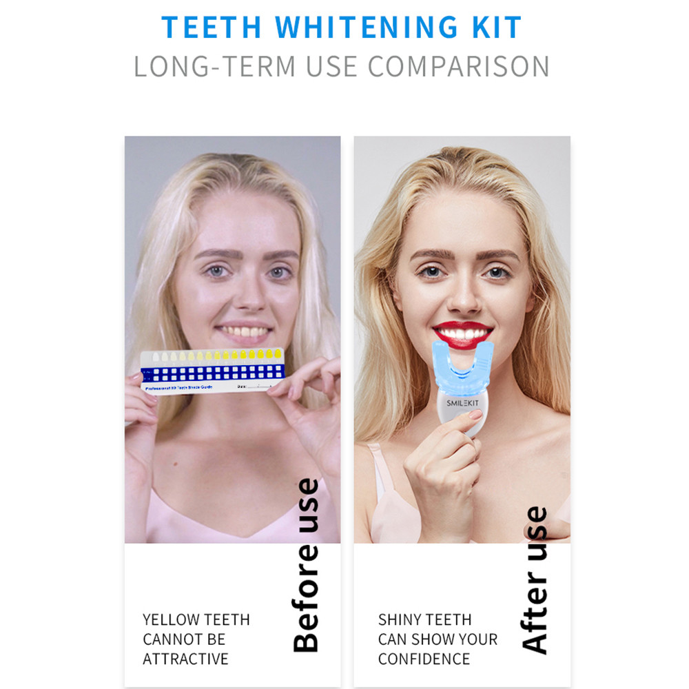Teeth Whitening Kit with LED Light Professional Cleaning Machine- Battery Operated_9 Teeth Whitening Kit with LED Light Professional Cleaning Machine- Battery Operated_9